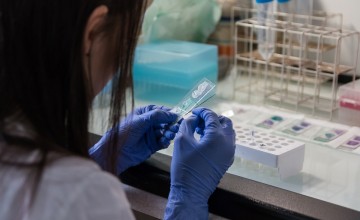 Een SOA Test doen bij de GGD? Dit moet je weten